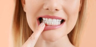 Пародонтоз