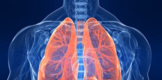 Пневмоторакс