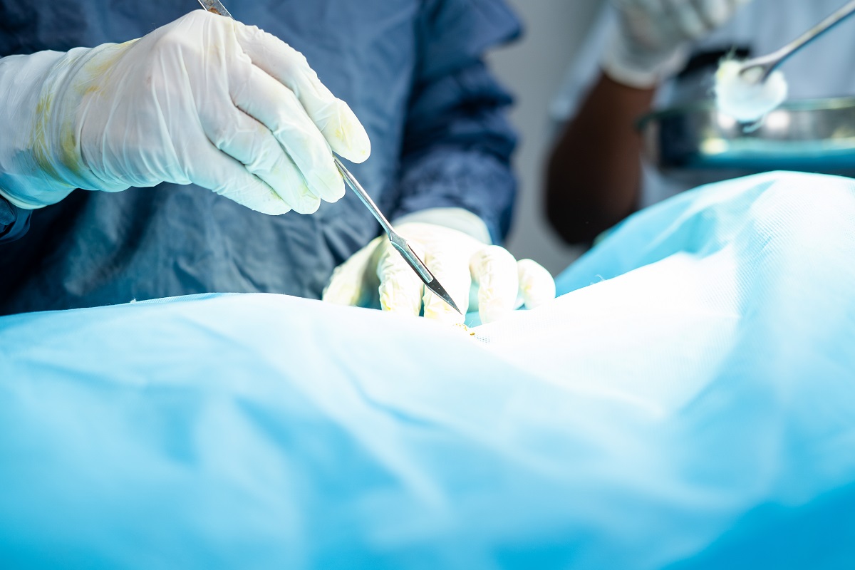 Fetus in fetu: хірурги витягли 8 ембріонів.  Фото: WESTOCK PRODUCTIONS / Shatterstock.com