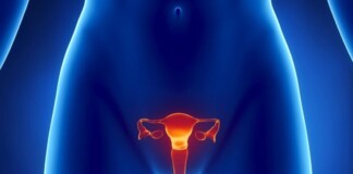 Бактеріальний вагіноз