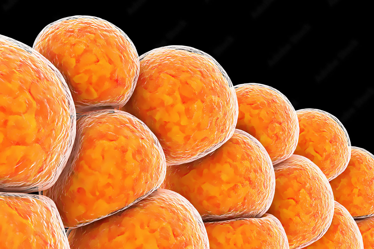 Як утворюється підшкірний жир?