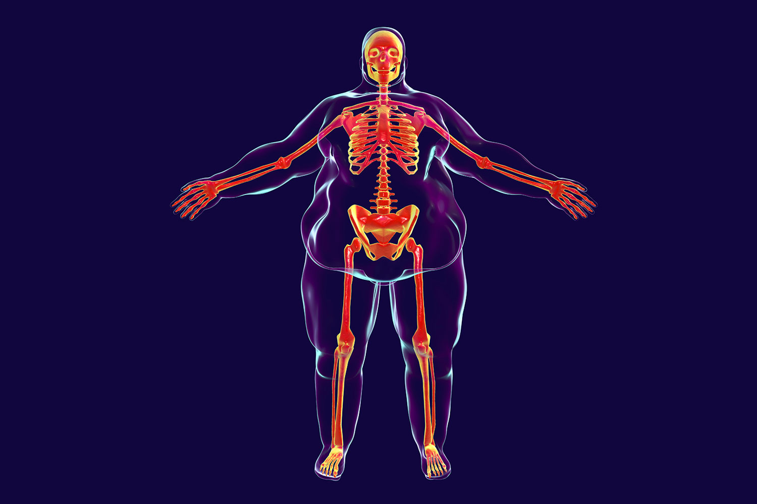 Як схуднути у ногах чоловікові?