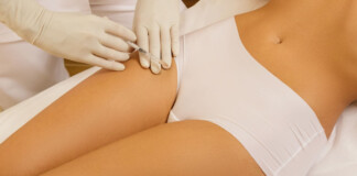 Інтимна пластика гінекологія