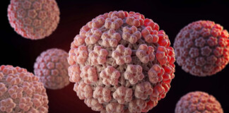 Вестибулярний папіломатоз