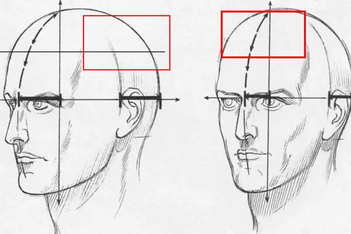 Етапи пересадки волосся