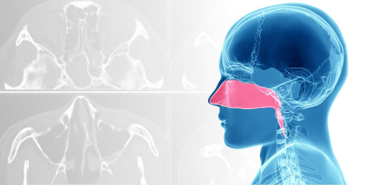 Кіста гайморових пазух Кіста гайморових пазух