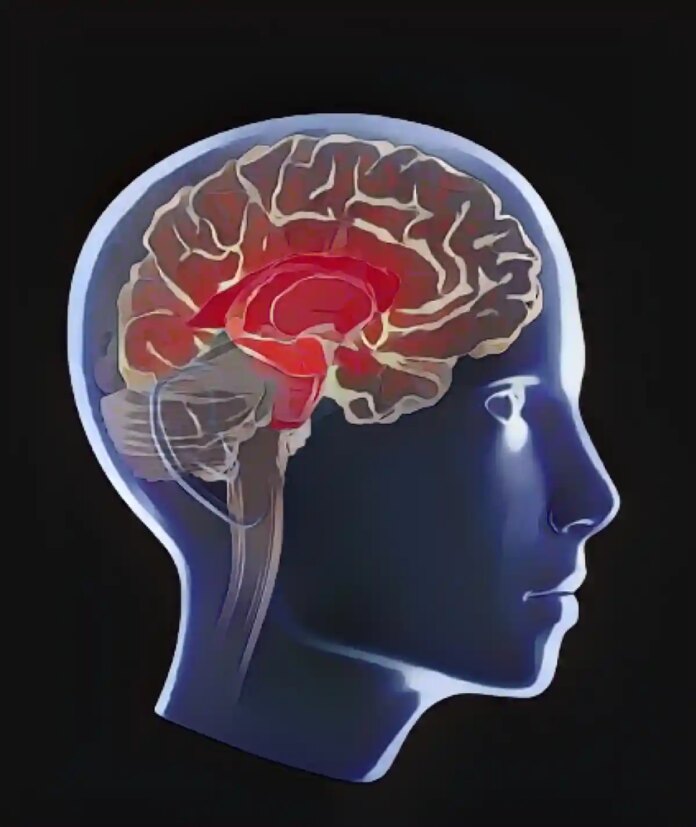 Препарат для лікування хвороби Альцгеймера схвалений у Європі