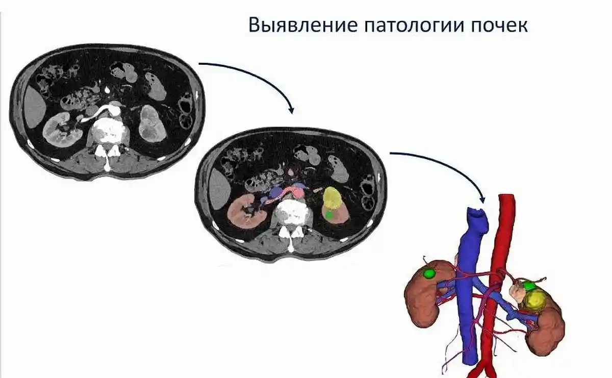 Візуалізація ідентифікованих патологій. Фото: aussiedlerbote.de