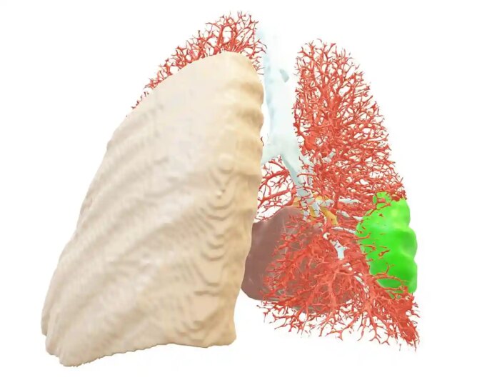 Проект Blumind AI діагностує захворювання краще, ніж будь -який лікар