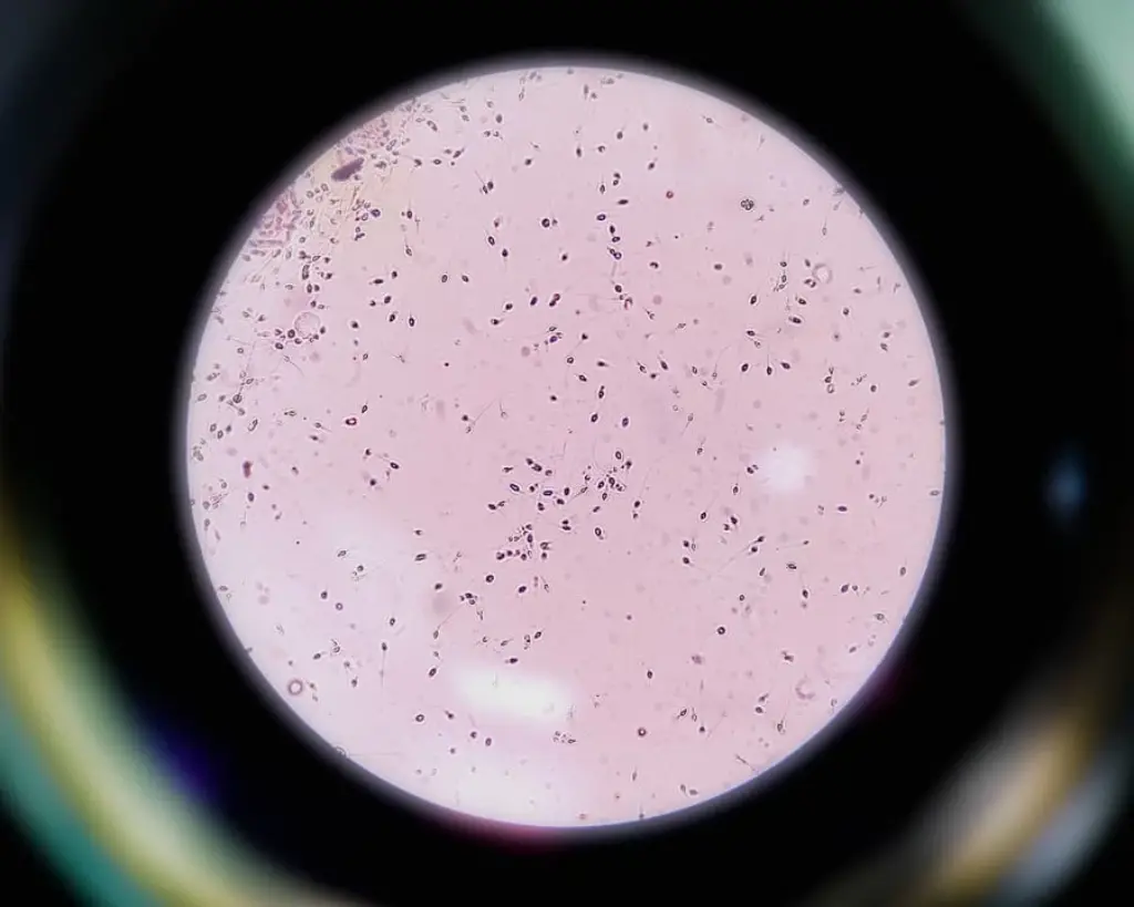 сперматозоїд