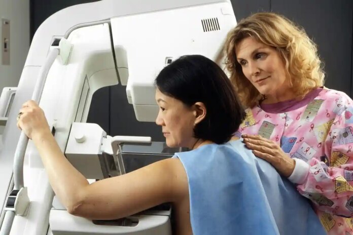 Програма мамографії Skreeting у Німеччині