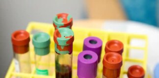 Як легко дізнатися ваш тип крові і чому це потрібно