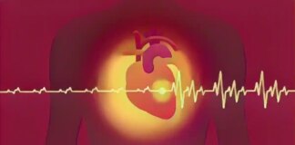 Серцевий напад: профілактика та перша допомога